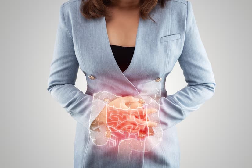 Doenças Inflamatórias Intestinais
